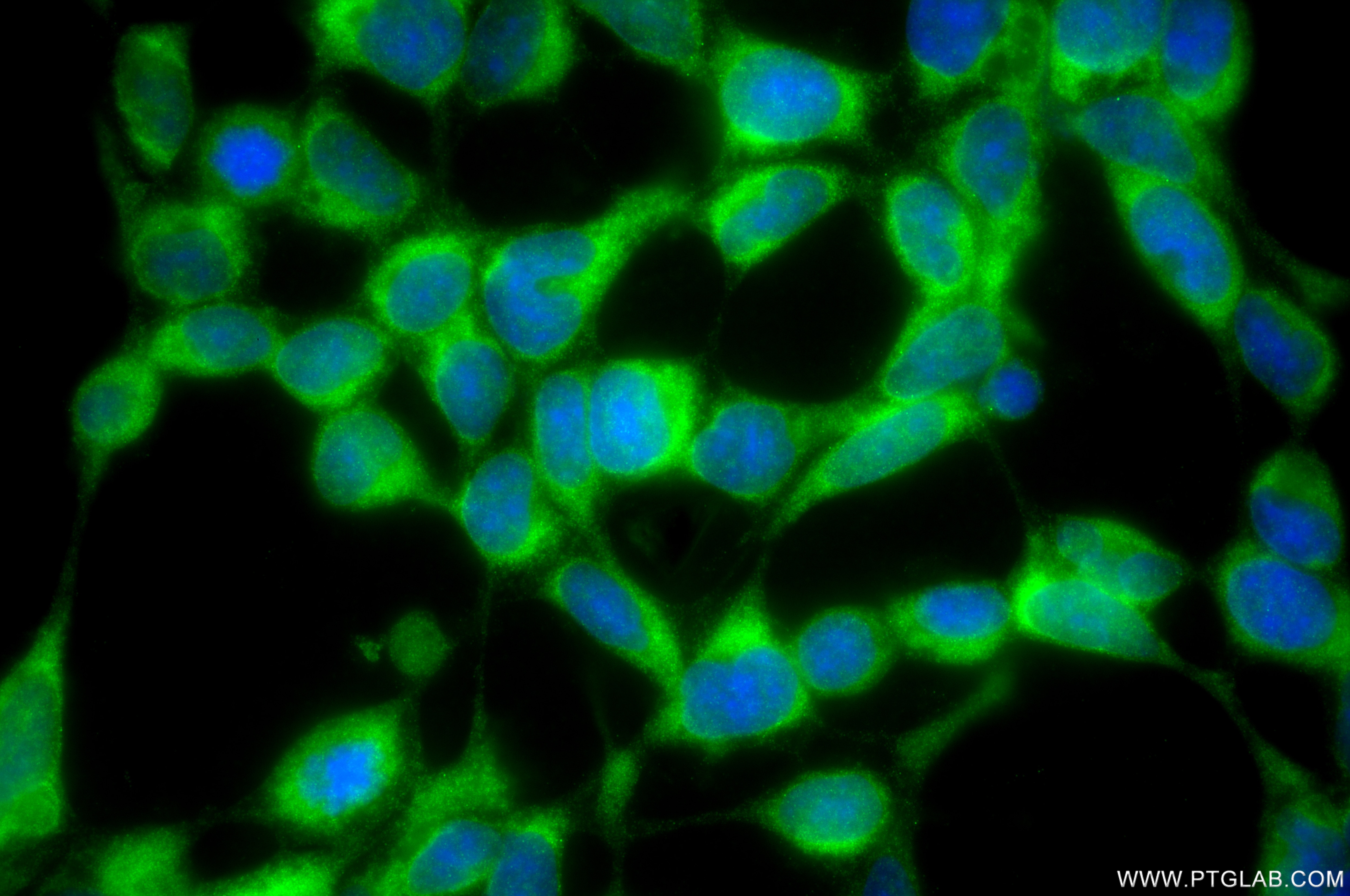 Immunofluorescent analysis of (-20°C Methanol) fixed HEK-293 cells using PKD2 antibody (82524-2-RR, Clone: 251151C3 ) at dilution of 1:400 and CoraLite®488-Conjugated Goat Anti-Rabbit IgG(H+L) (SA00013-2). Immunofluorescence (IF) / fluorescent staining of HEK-293 cells using PKD2 Recombinant monoclonal antibody (82524-2-RR)