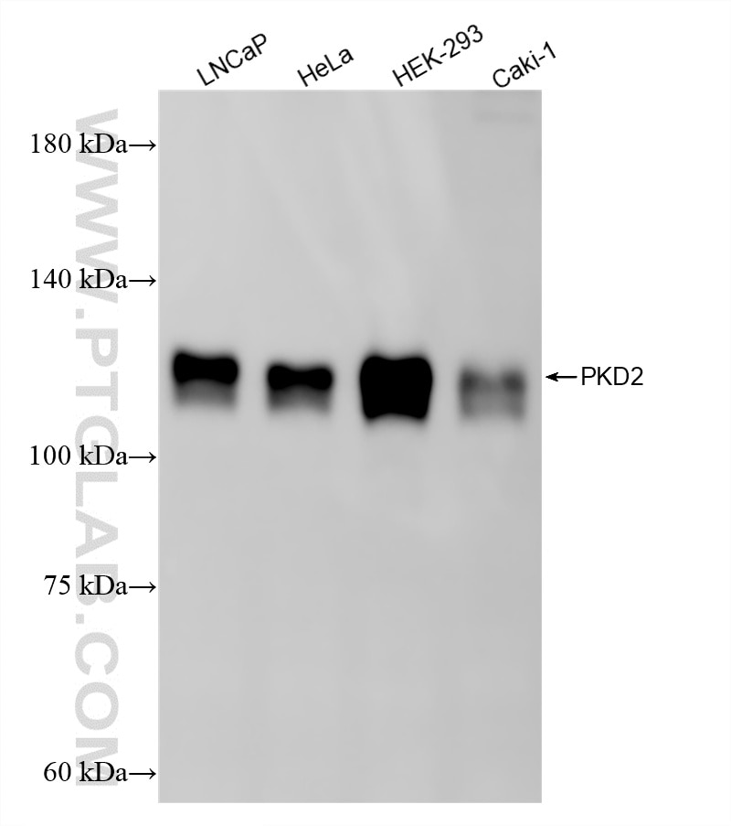Various lysates were subjected to SDS PAGE followed by western blot with 82524-2-RR (PKD2 antibody) at dilution of 1:2000 incubated at room temperature for 1.5 hours. Western Blot (WB) analysis of various lysates using PKD2 Recombinant monoclonal antibody (82524-2-RR)