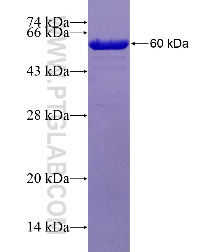 PKD2 fusion protein Ag29566 SDS-PAGE