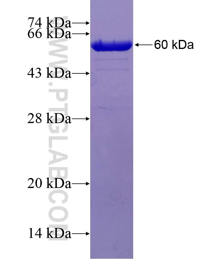 PKD2 fusion protein Ag29566 SDS-PAGE