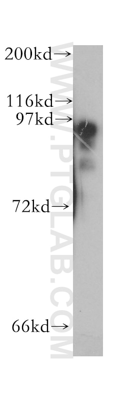 Western Blot (WB) analysis of human liver tissue using PKD2L1 Polyclonal antibody (13117-2-AP)