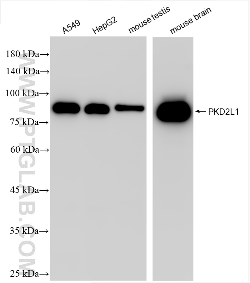 Western Blot (WB) analysis of various lysates using PKD2L1 Recombinant antibody (86062-2-RR)