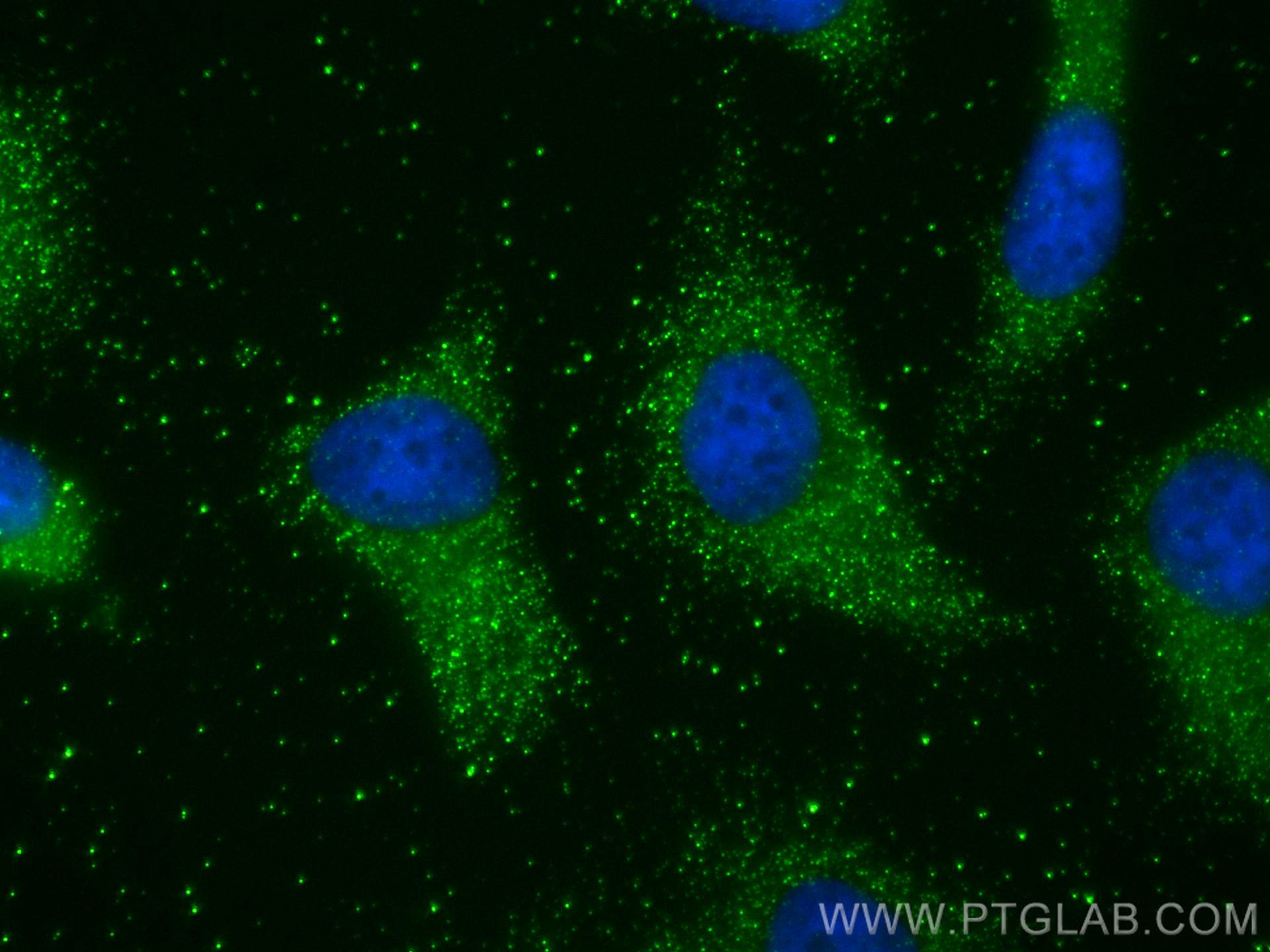 Immunofluorescence (IF) / fluorescent staining of HeLa cells using PKIA Polyclonal antibody (11743-1-AP)