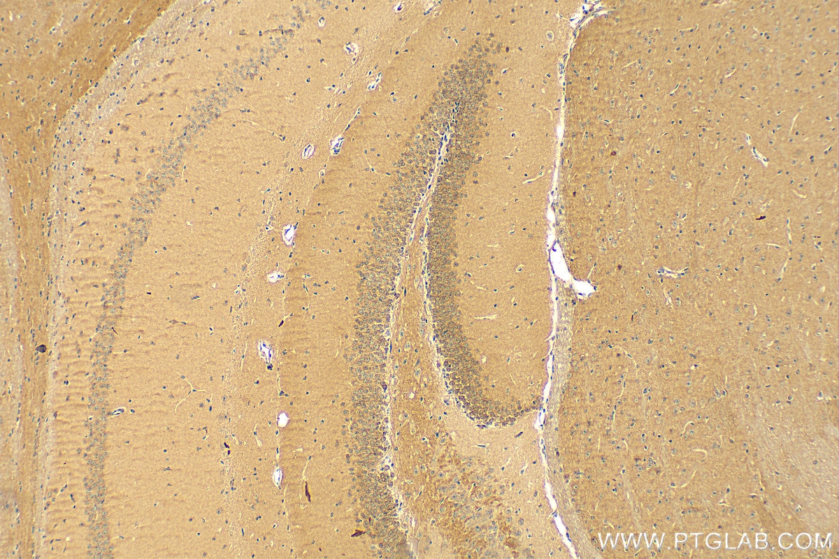 Immunohistochemistry (IHC) staining of mouse brain tissue using PKIA Polyclonal antibody (11743-1-AP)