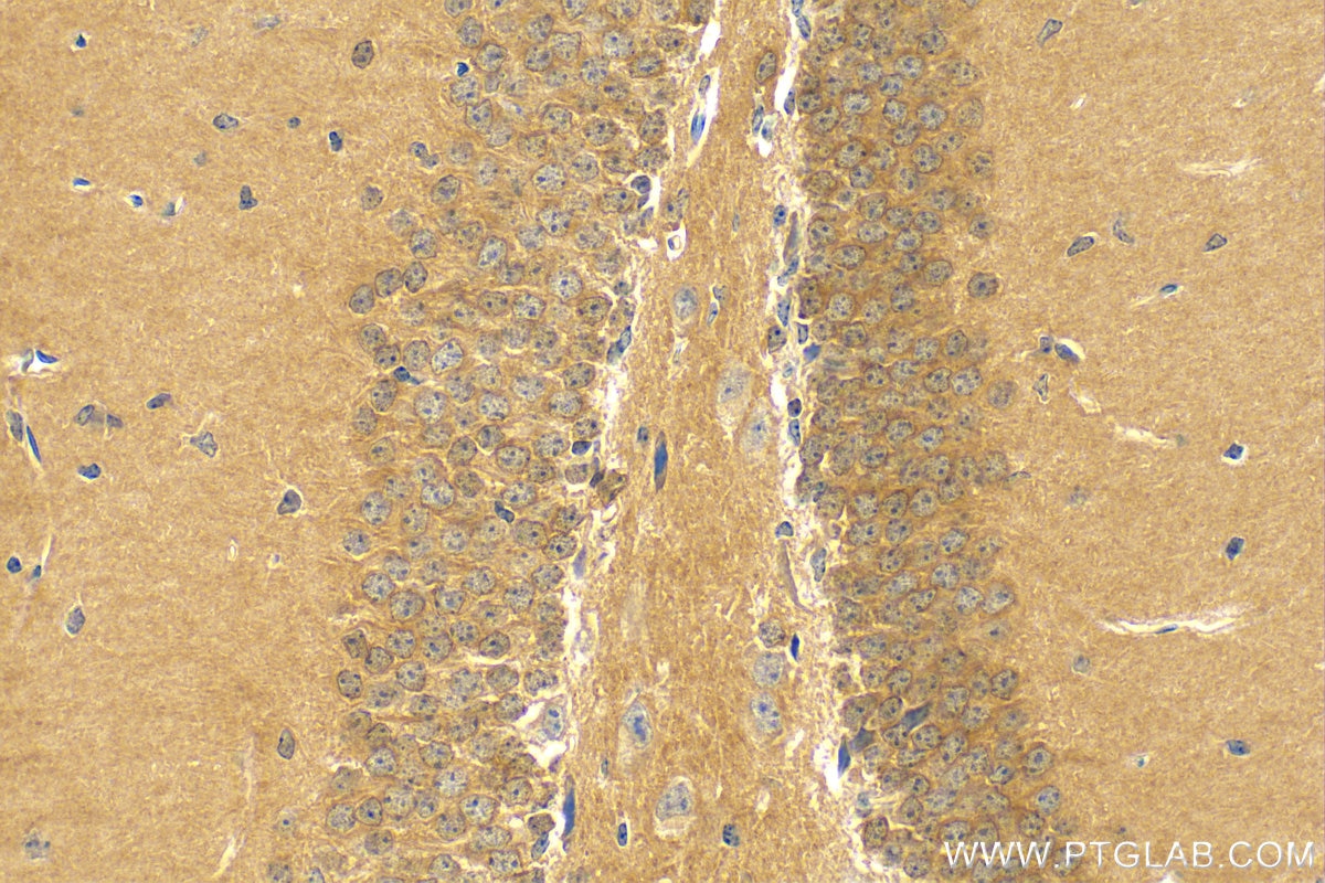 Immunohistochemistry (IHC) staining of mouse brain tissue using PKIA Polyclonal antibody (11743-1-AP)