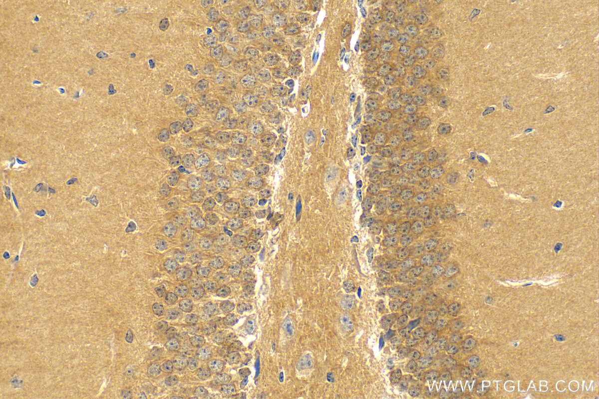 IHC staining of mouse brain using 11743-1-AP