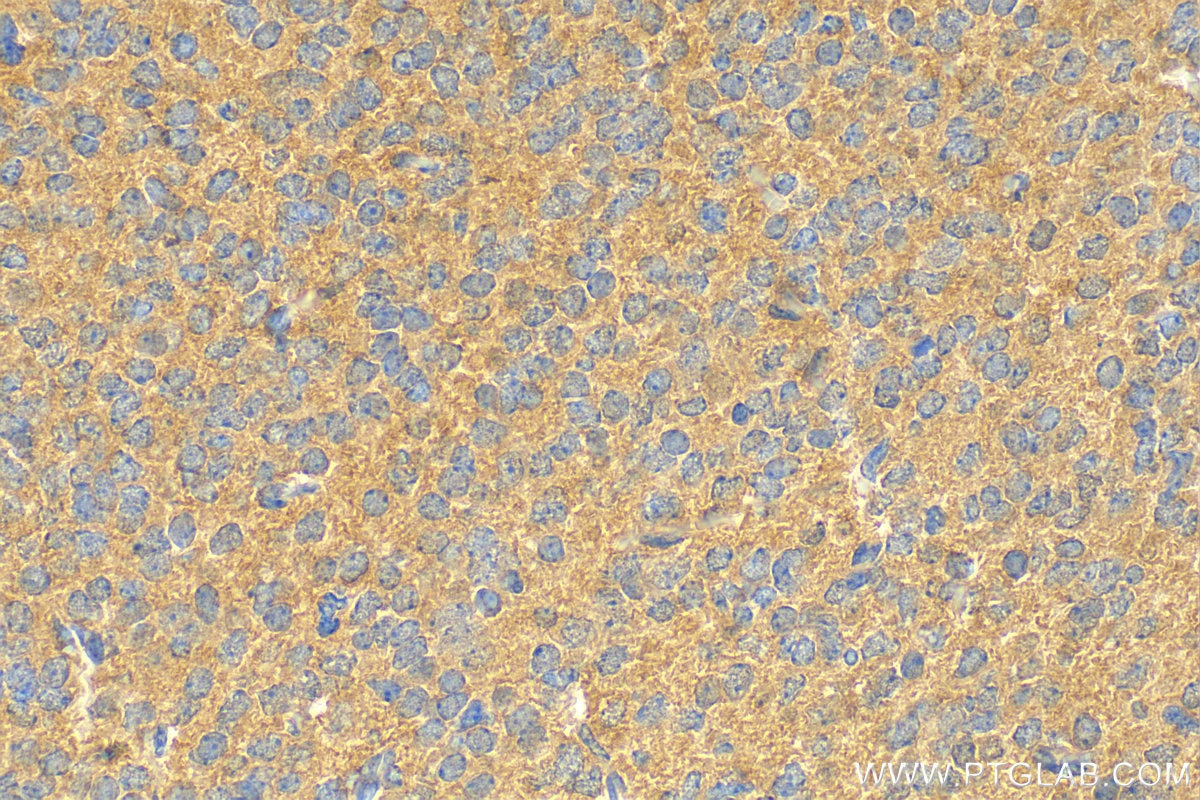 Immunohistochemistry (IHC) staining of mouse embryo tissue using PKIA Polyclonal antibody (11743-1-AP)