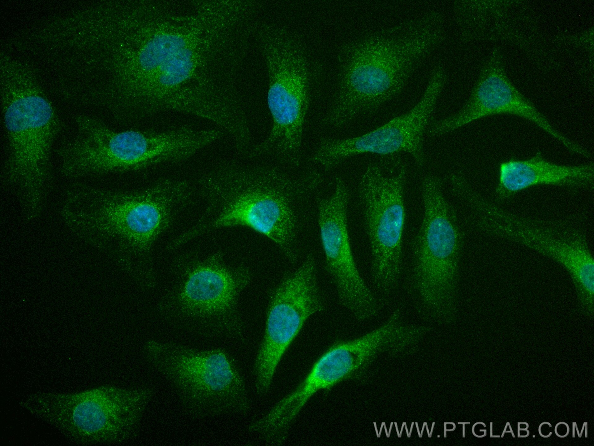 IF Staining of HeLa using CL488-11743