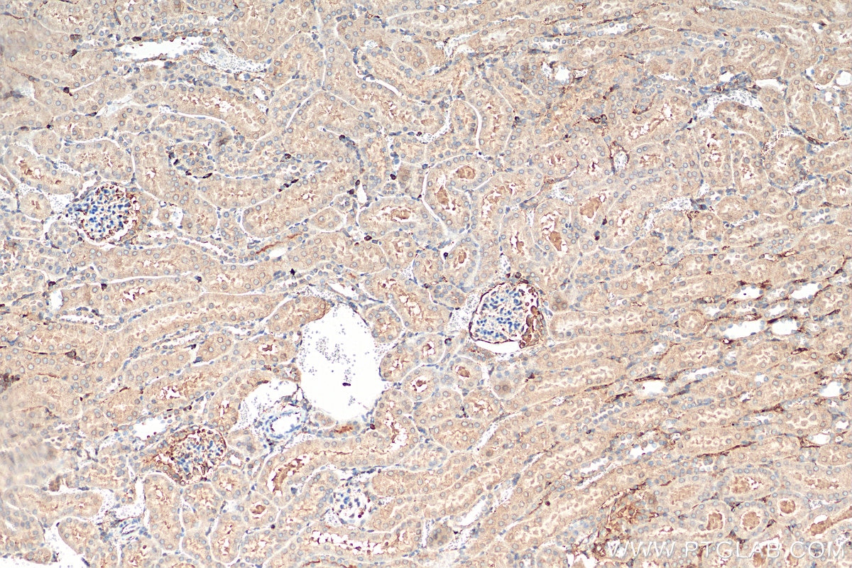 Immunohistochemistry (IHC) staining of mouse kidney tissue using PKIB Polyclonal antibody (11942-1-AP)