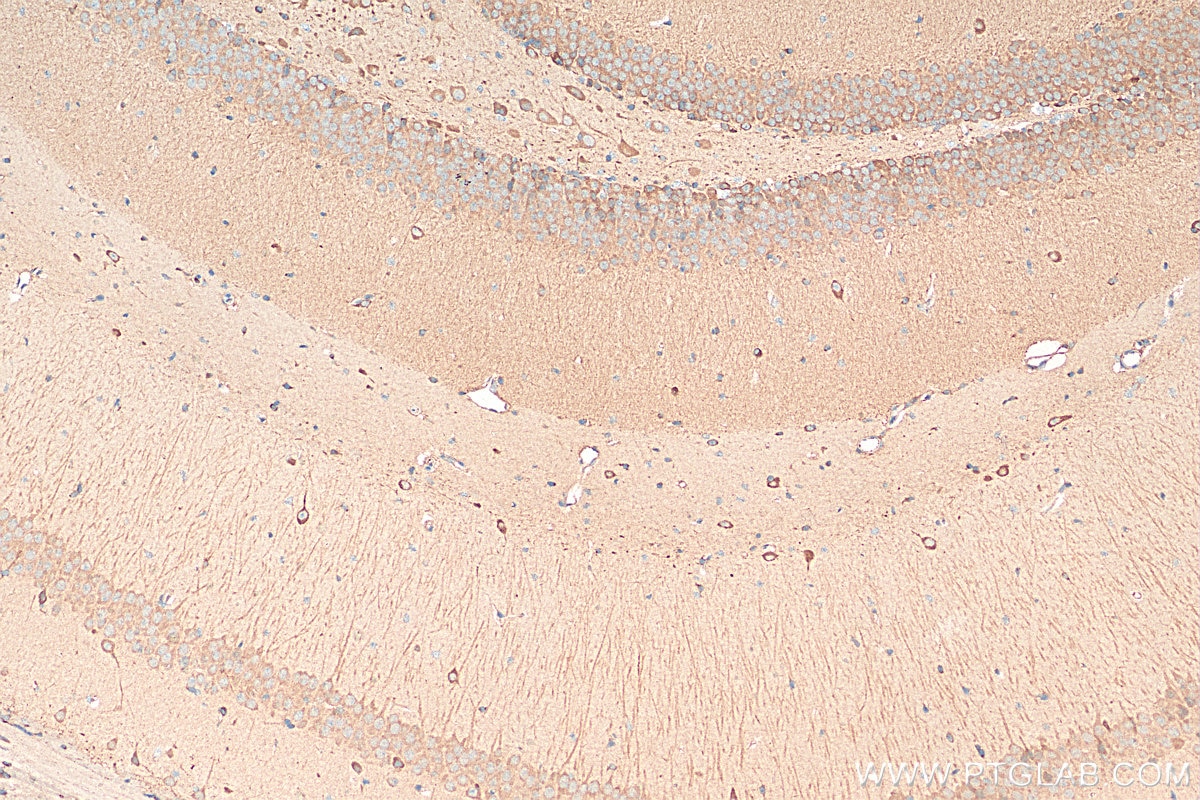 IHC staining of mouse brain using 11942-1-AP