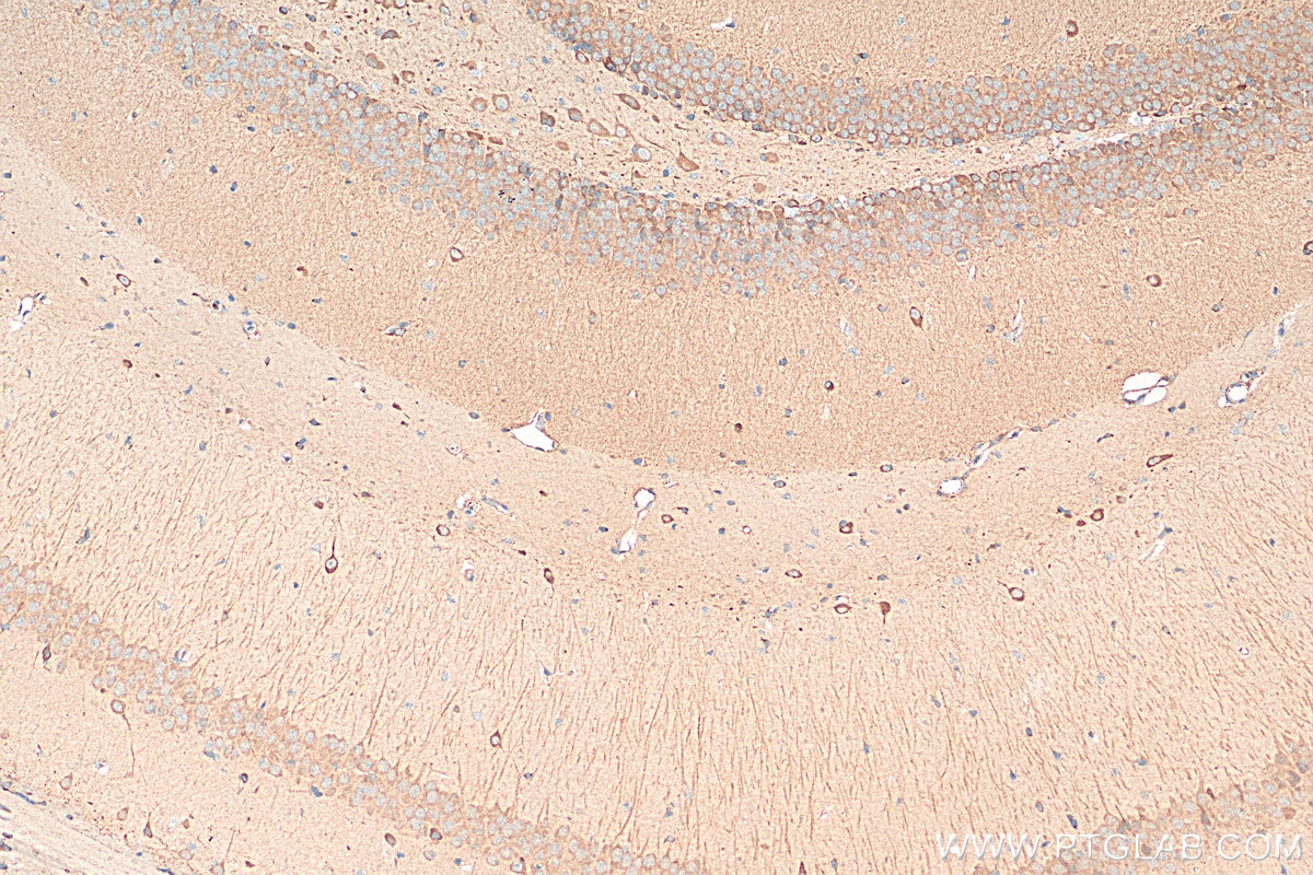 Immunohistochemistry (IHC) staining of mouse brain tissue using PKIB Polyclonal antibody (11942-1-AP)