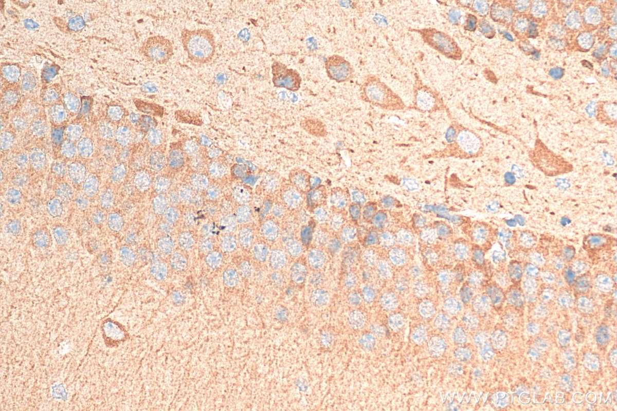 Immunohistochemistry (IHC) staining of mouse brain tissue using PKIB Polyclonal antibody (11942-1-AP)