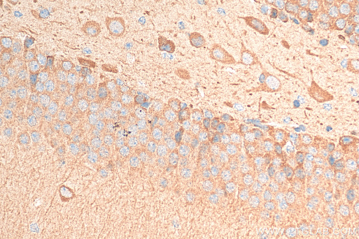 IHC staining of mouse brain using 11942-1-AP