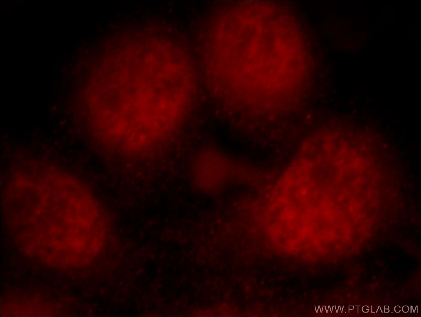Immunofluorescence (IF) / fluorescent staining of HeLa cells using PKIG Polyclonal antibody (21371-1-AP)