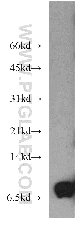 Western Blot (WB) analysis of mouse heart tissue using PKIG Polyclonal antibody (21371-1-AP)