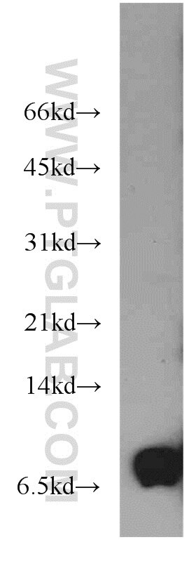 Western Blot (WB) analysis of mouse heart tissue using PKIG Polyclonal antibody (21371-1-AP)