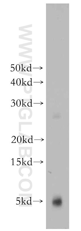 Western Blot (WB) analysis of mouse heart tissue using PKIG Polyclonal antibody (21371-1-AP)