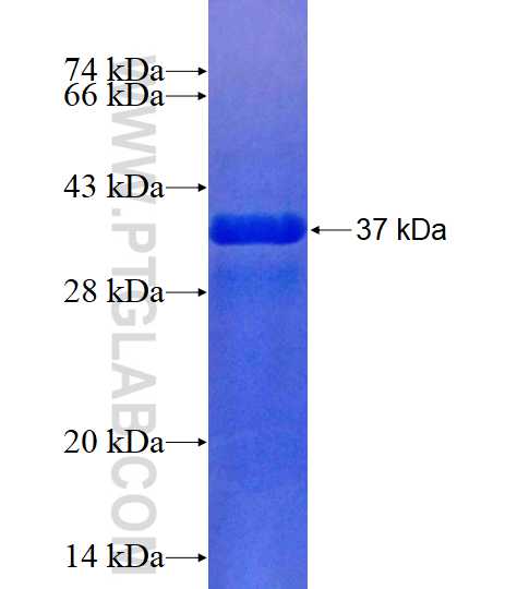 PKIG fusion protein Ag15878 SDS-PAGE