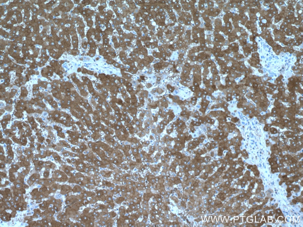 Immunohistochemistry (IHC) staining of human liver tissue using PKLR Polyclonal antibody (17580-1-AP)