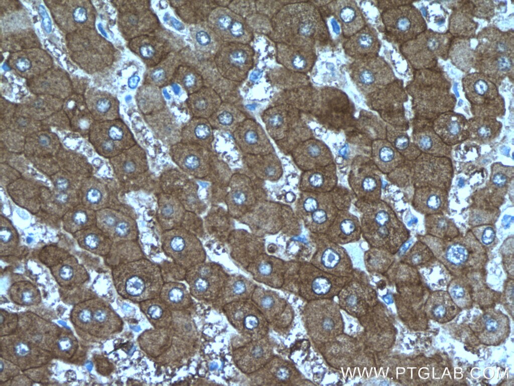 Immunohistochemistry (IHC) staining of human liver tissue using PKLR Polyclonal antibody (17580-1-AP)