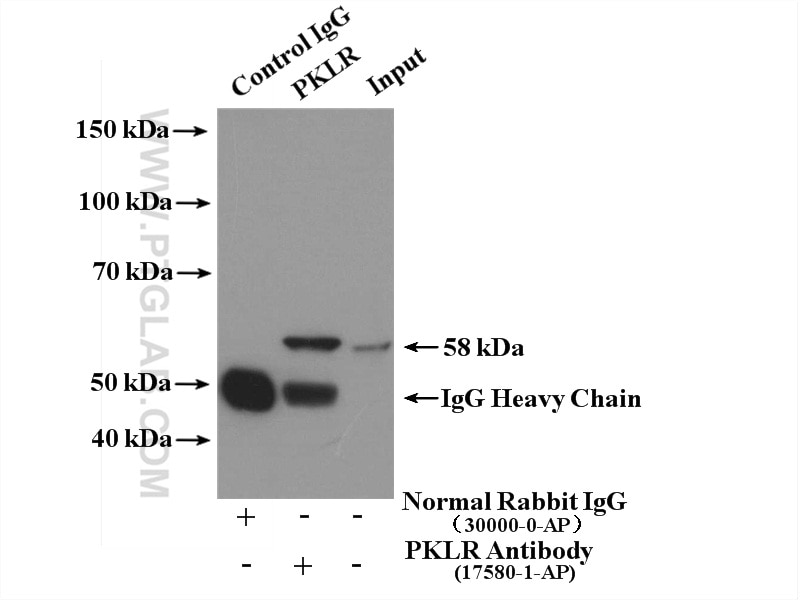 Immunoprecipitation (IP) experiment of K-562 cells using PKLR Polyclonal antibody (17580-1-AP)