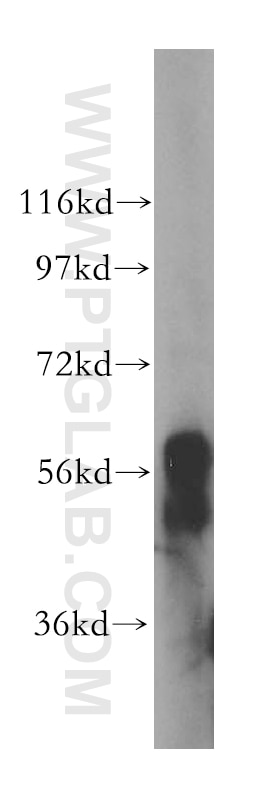 Western Blot (WB) analysis of mouse liver tissue using PKLR Polyclonal antibody (17580-1-AP)