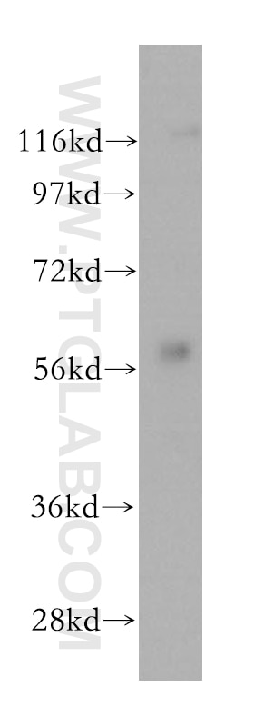 Western Blot (WB) analysis of mouse kidney tissue using PKLR Polyclonal antibody (17580-1-AP)