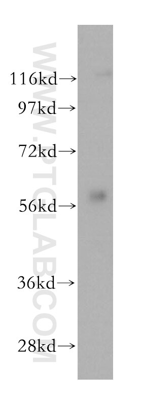 WB analysis of mouse kidney using 17580-1-AP