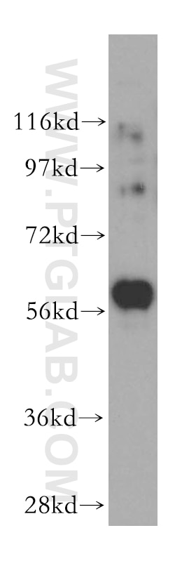 Western Blot (WB) analysis of K-562 cells using PKLR Polyclonal antibody (17580-1-AP)