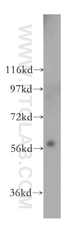 Western Blot (WB) analysis of NIH/3T3 cells using PKLR Polyclonal antibody (17580-1-AP)