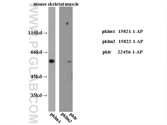 WB analysis of mouse skeletal muscle tissue using 22456-1-AP