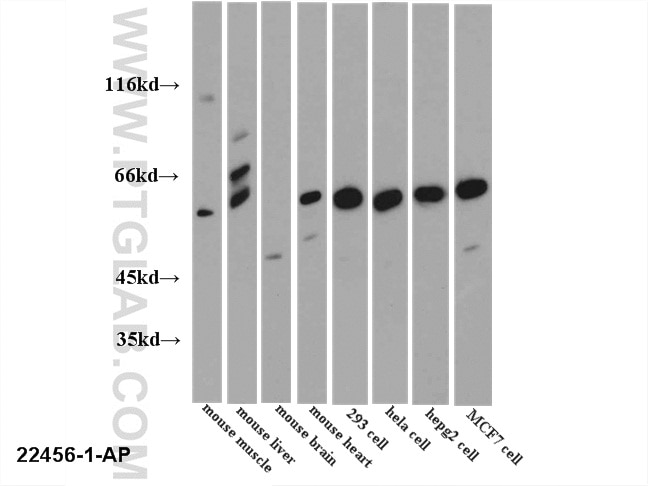 Western Blot (WB) analysis of multi-cells/tissue using PKLR Polyclonal antibody (22456-1-AP)