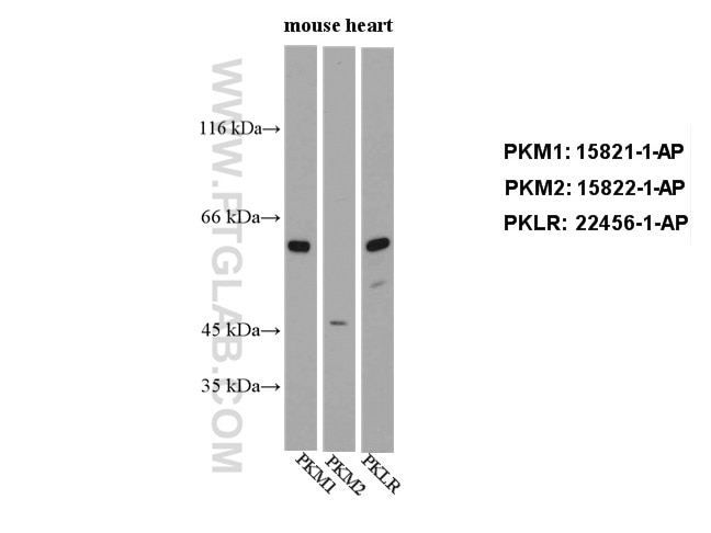 Western Blot (WB) analysis of mouse heart tissue using PKLR Polyclonal antibody (22456-1-AP)