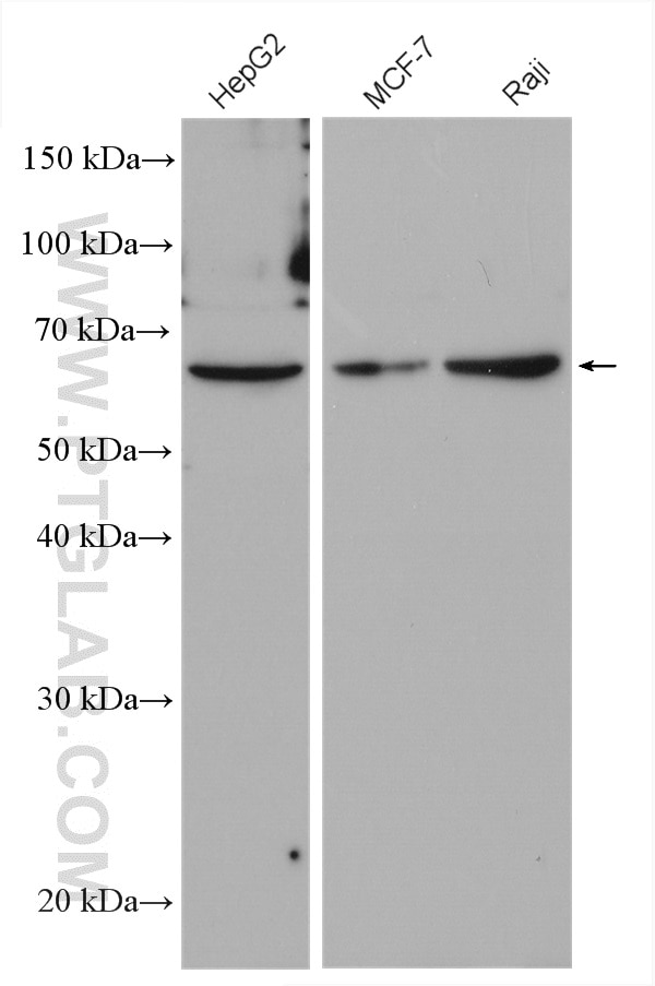 Western Blot (WB) analysis of various lysates using PKLR Polyclonal antibody (22456-1-AP)