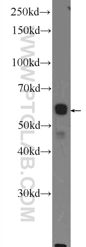 Western Blot (WB) analysis of HEK-293 cells using PKLR Polyclonal antibody (22456-1-AP)