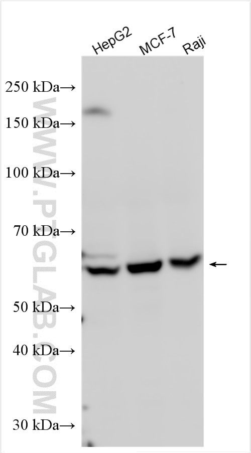 Western Blot (WB) analysis of various lysates using PKLR Polyclonal antibody (22456-1-AP)