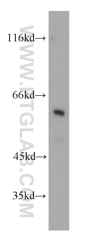 Western Blot (WB) analysis of HeLa cells using PKLR Polyclonal antibody (22456-1-AP)