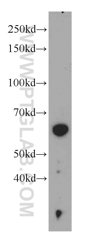 Western Blot (WB) analysis of MCF-7 cells using PKLR Polyclonal antibody (22456-1-AP)