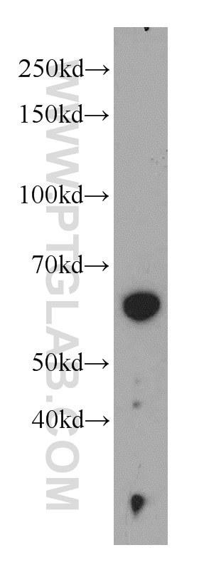 WB analysis of MCF-7 using 22456-1-AP