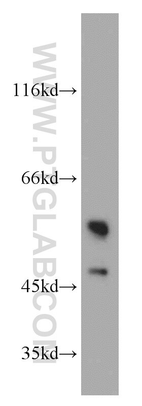 Western Blot (WB) analysis of human kidney tissue using PKLR Polyclonal antibody (22456-1-AP)