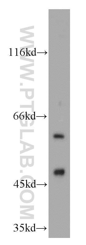 Western Blot (WB) analysis of human liver tissue using PKLR Polyclonal antibody (22456-1-AP)