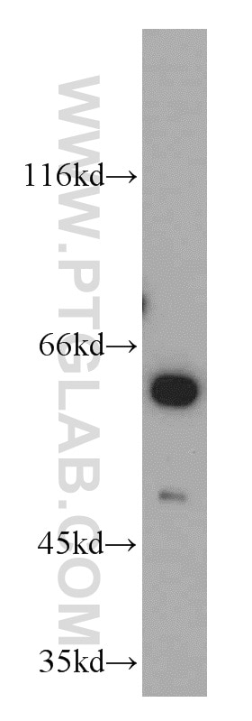 Western Blot (WB) analysis of NIH/3T3 cells using PKLR Polyclonal antibody (22456-1-AP)