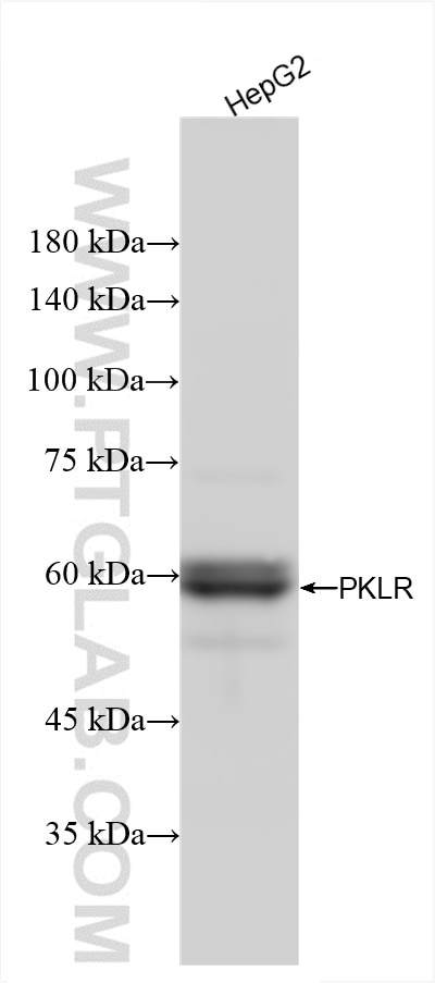 Western Blot (WB) analysis of HepG2 cells using PKLR Recombinant antibody (86485-1-RR)