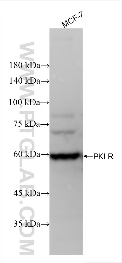 Western Blot (WB) analysis of MCF-7 cells using PKLR Recombinant antibody (86485-1-RR)