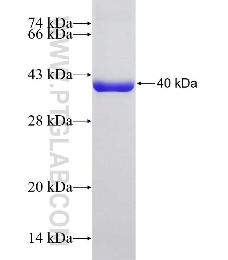 PKLR fusion protein Ag11096 SDS-PAGE