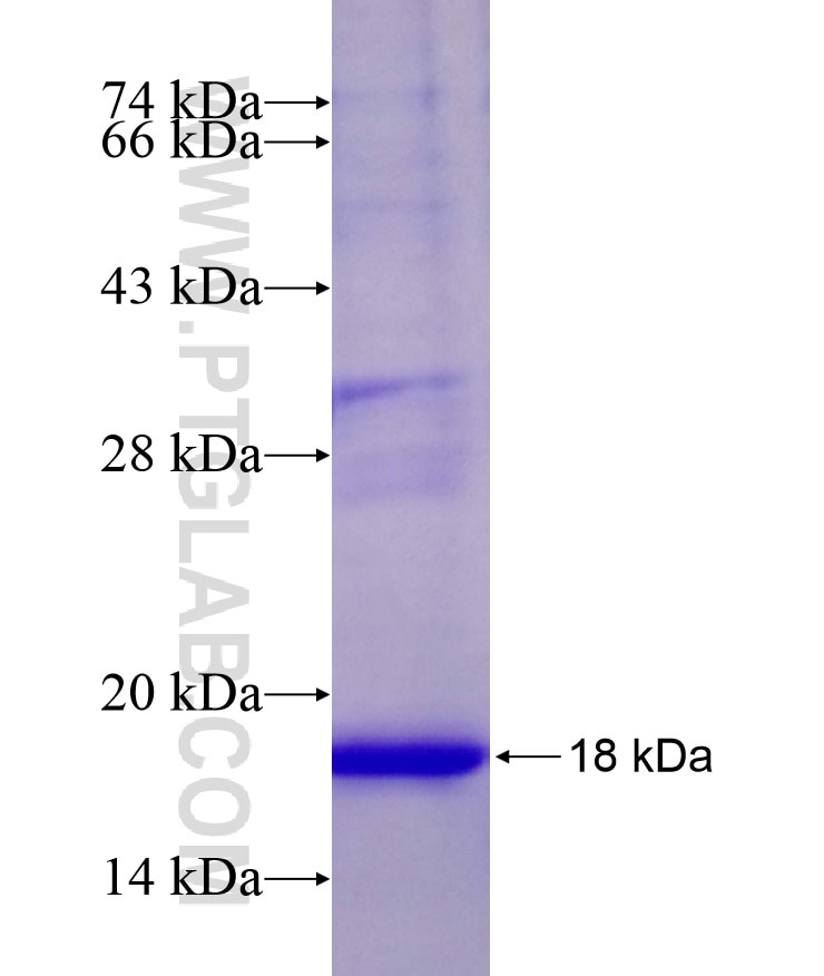 PKLR fusion protein Ag17884 SDS-PAGE
