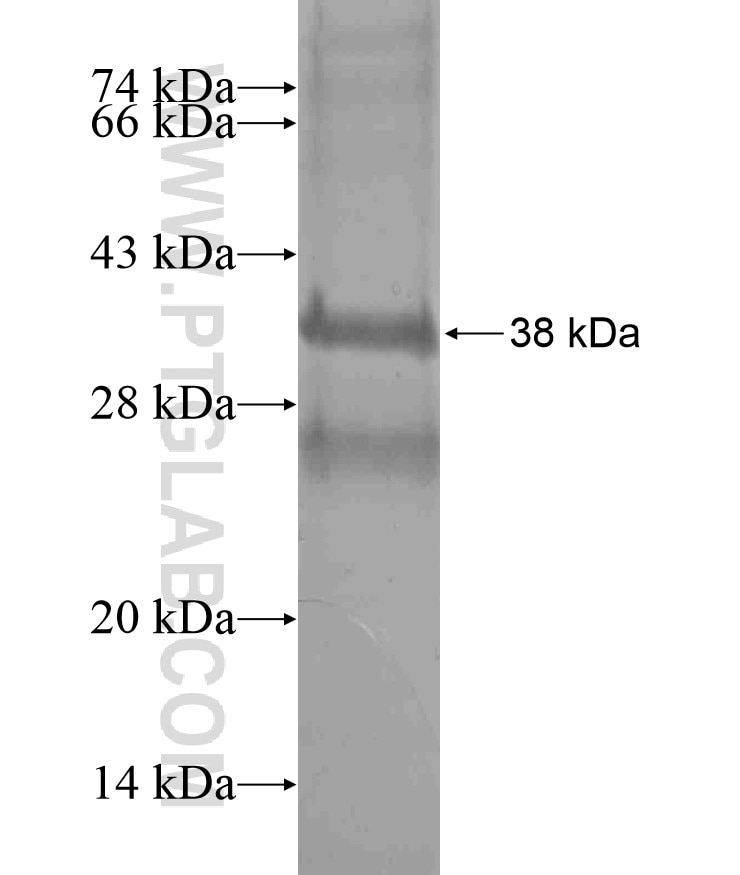 PKLR fusion protein Ag17933 SDS-PAGE