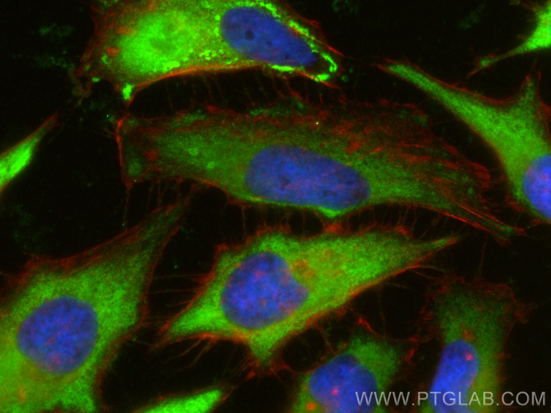 Immunofluorescence (IF) / fluorescent staining of HeLa cells using PKM Polyclonal antibody (25659-1-AP)