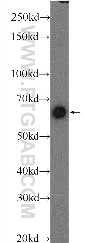 Western Blot (WB) analysis of HEK-293 cells using PKM Polyclonal antibody (25659-1-AP)