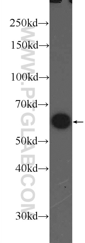 Western Blot (WB) analysis of MCF-7 cells using PKM Polyclonal antibody (25659-1-AP)